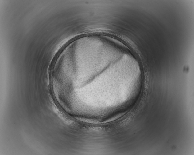 X0000115011031200911161556