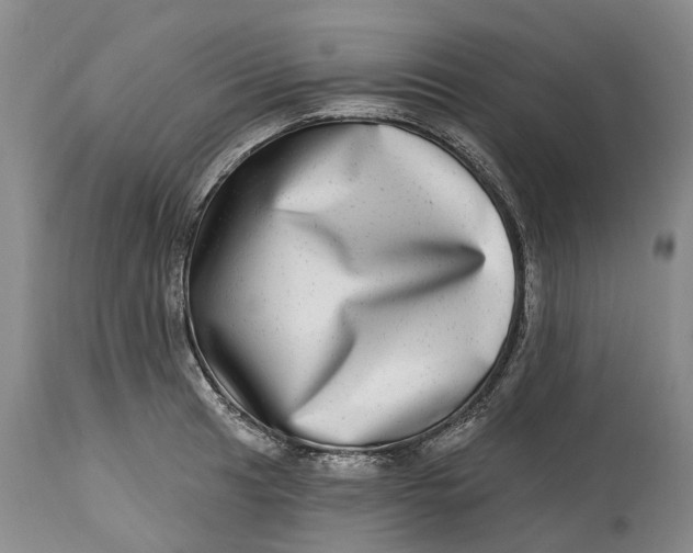 X0000115011041200911161556