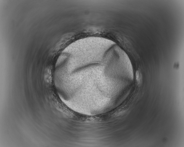 X0000115011203200911161552