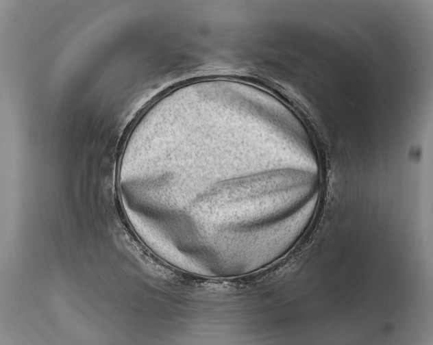X0000115011220200911161552