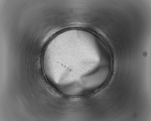 X0000115011259200911161552