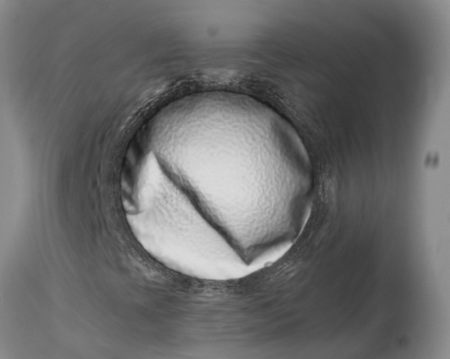 X0000115011393200911161549