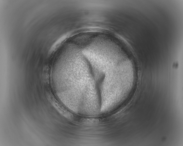 X0000115011403200911161549