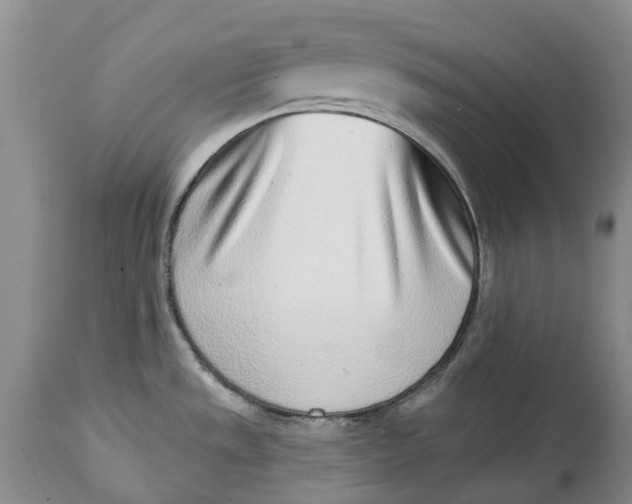 X0000115011533200911161548