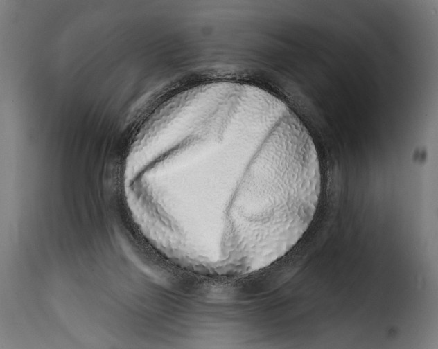 X0000115010165200911231235