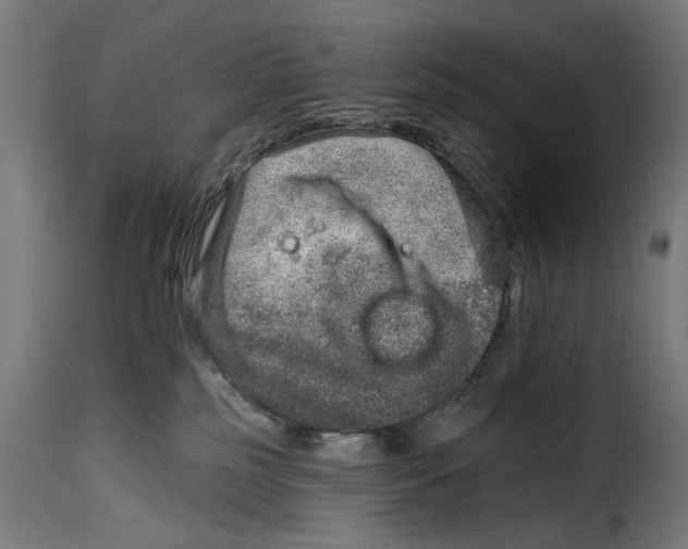 X0000115010185200911231235