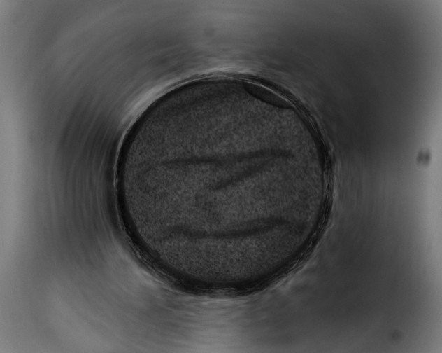 X0000115010196200911231234
