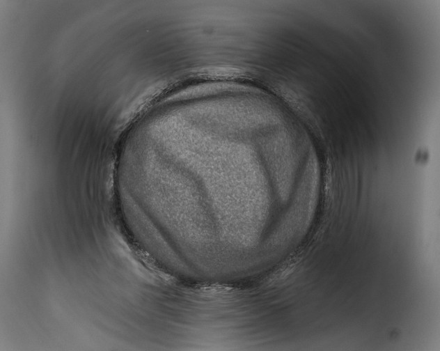 X0000115010206200911231234