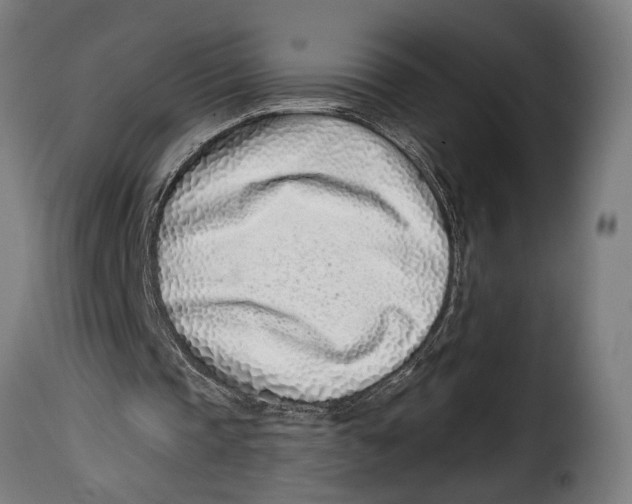 X0000115010337200911231231