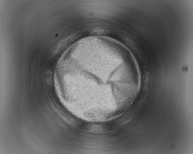 X0000115010361200911231232