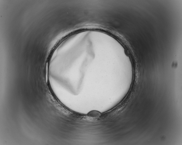 X0000115011175200911231220