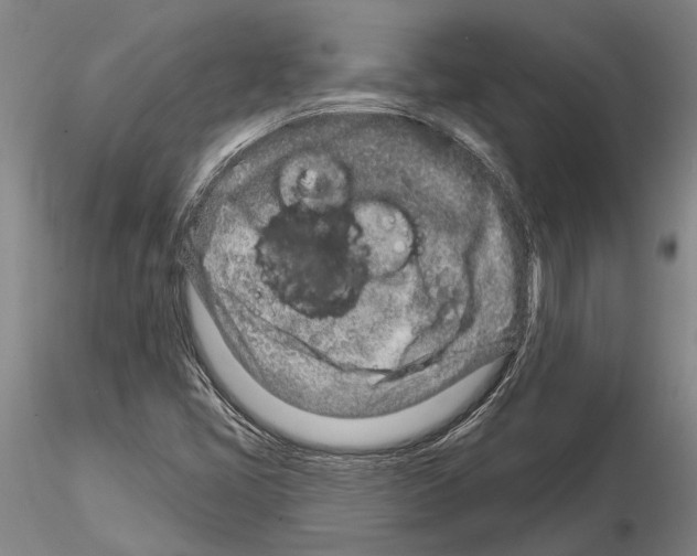 X0000115011405200912071153