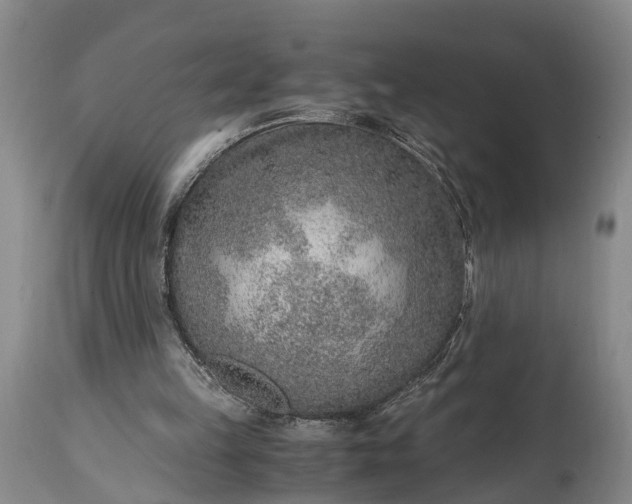 X0000115020149200911091450