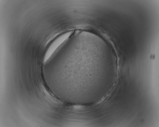 X0000115020154200911091450