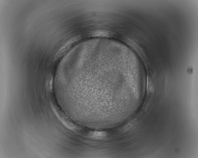 X0000115020157200911091450