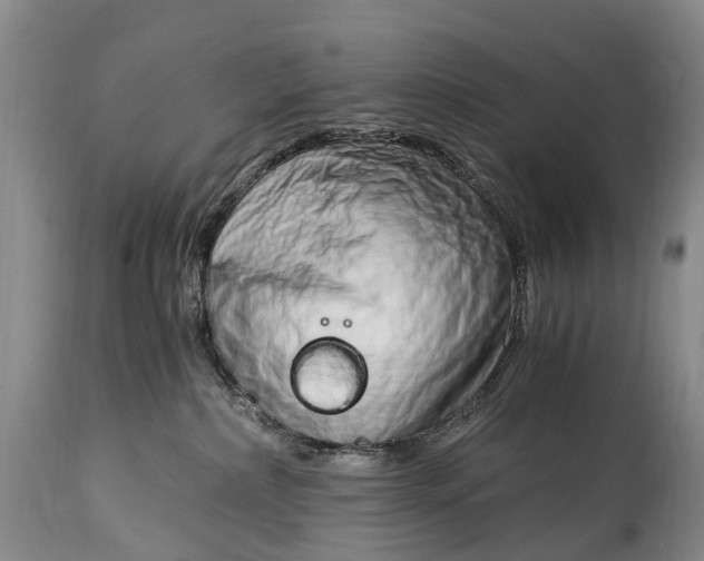 X0000115020236200911091449