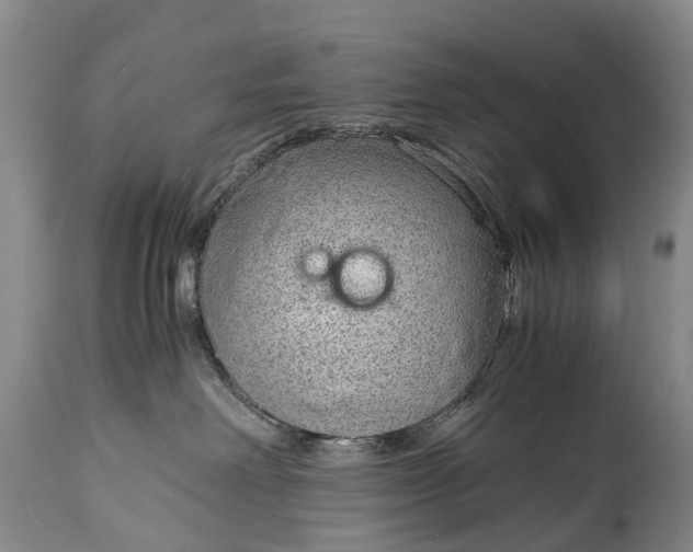 X0000115020238200911091449