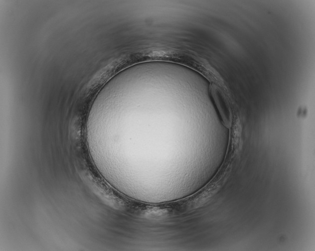 X0000115020257200911091449