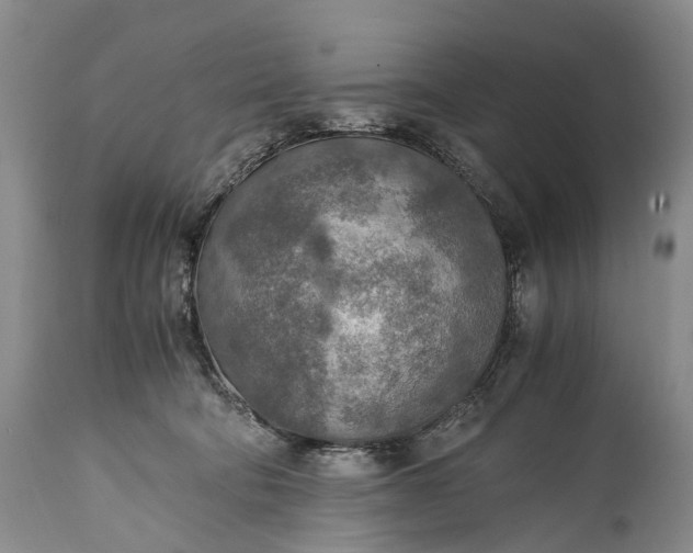 X0000115020322200911091448