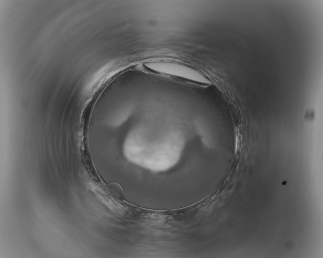 X0000115020339200911091447