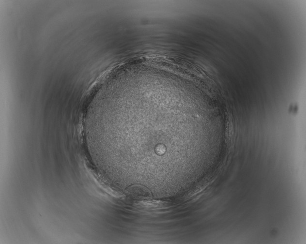 X0000115020367200911091448