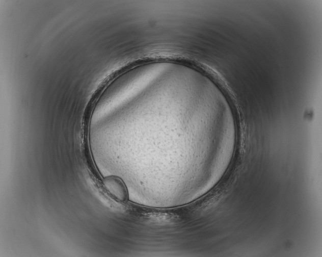 X0000115020439200911091446