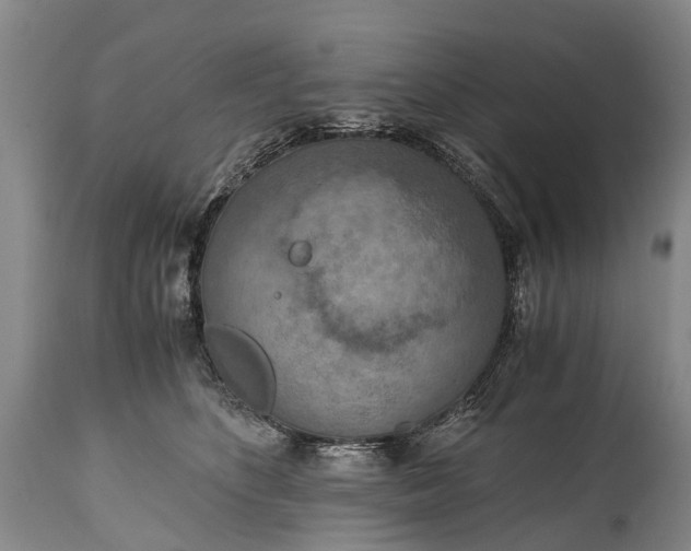 X0000115020516200911091445