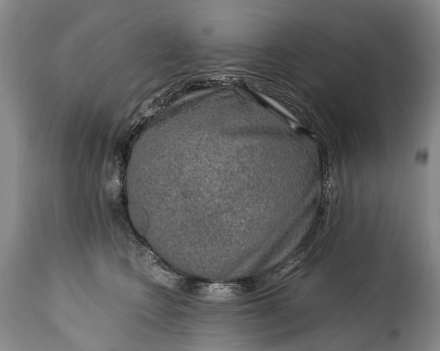 X0000115020566200911091445