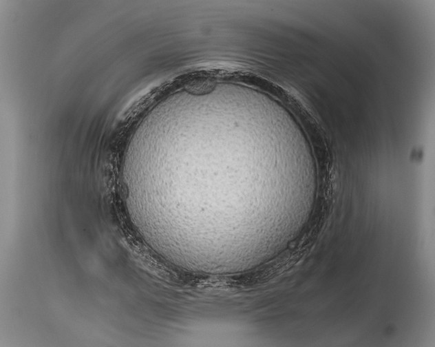 X0000115020967200911091439