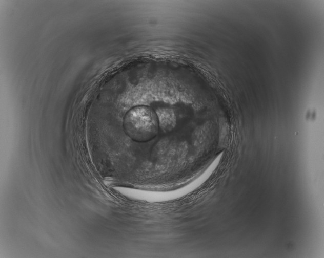 X0000115021009200911091438