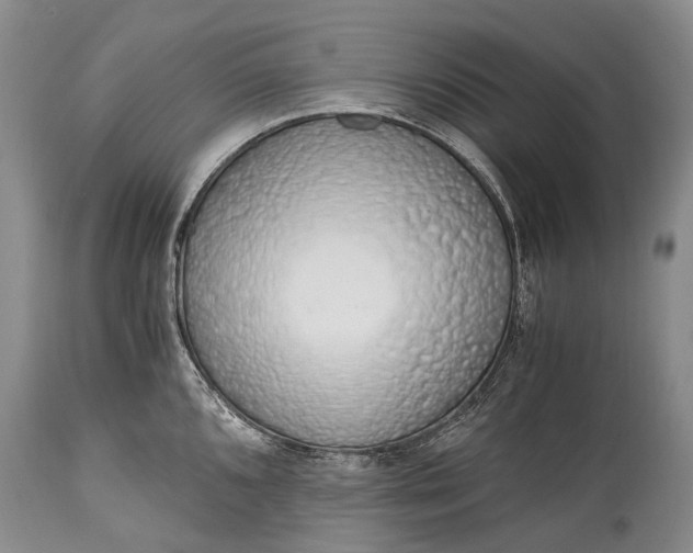 X0000115021096200911091437