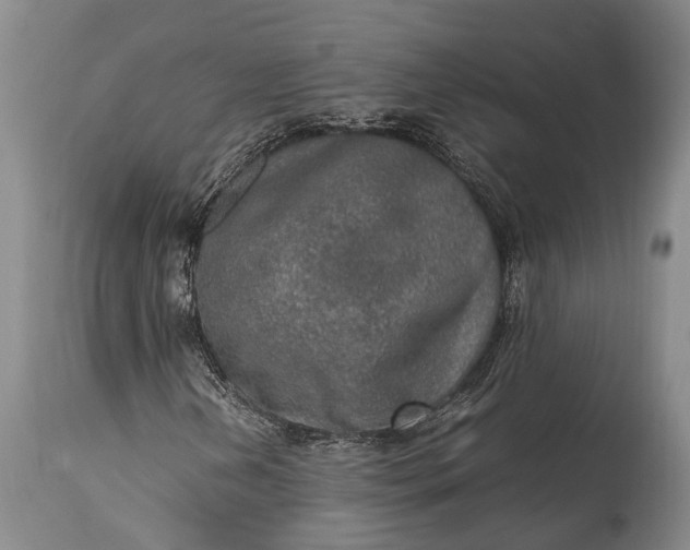 X0000115021202200911091435