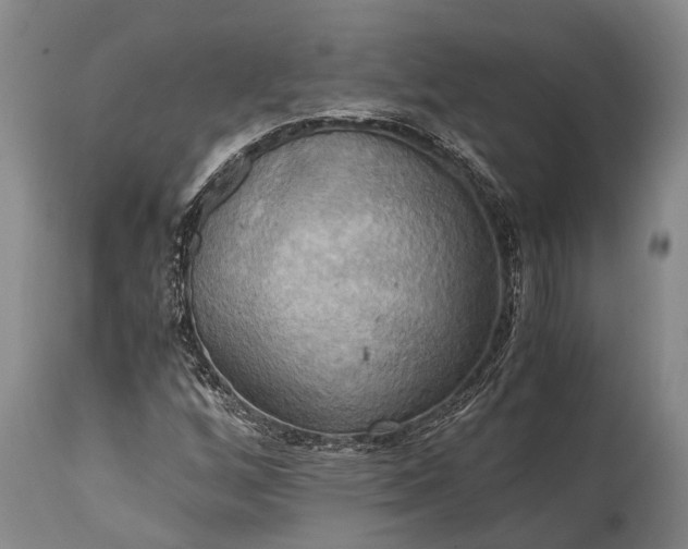 X0000115021256200911091435
