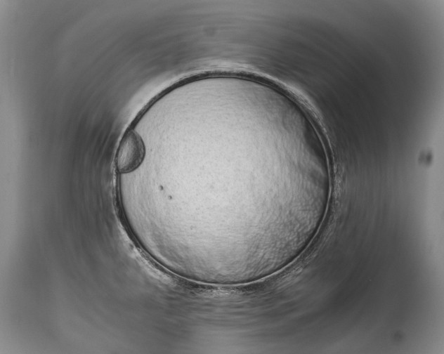 X0000115021287200911091434