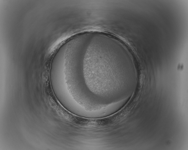 X0000115021359200911091433