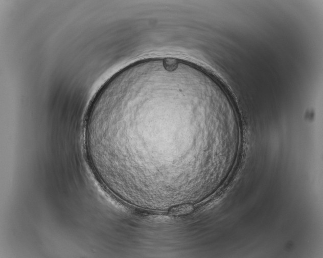 X0000115021517200911091431