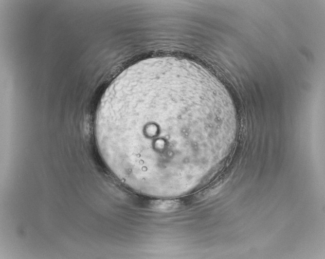 X0000115020135200911161454