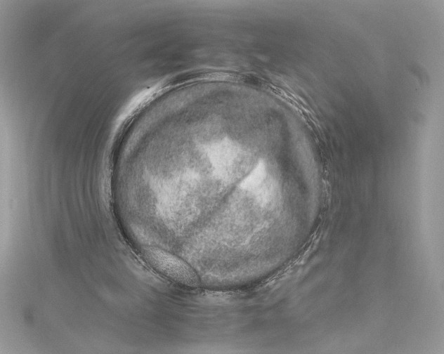 X0000115020149200911161453