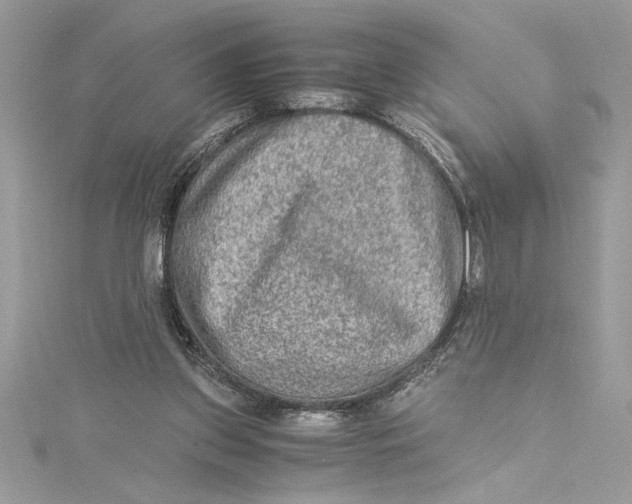 X0000115020157200911161454