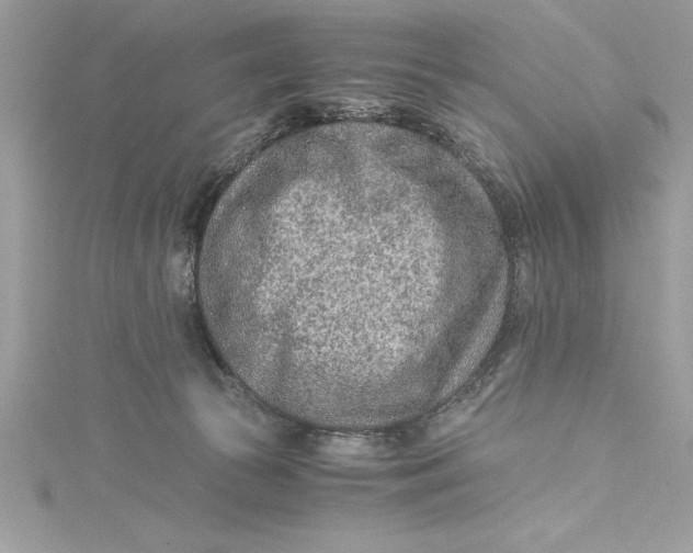 X0000115020177200911161454