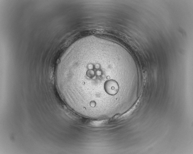 X0000115020178200911161454