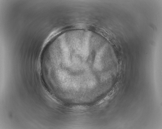 X0000115020198200911161453