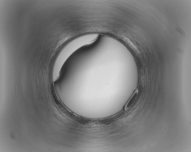 X0000115020207200911161453