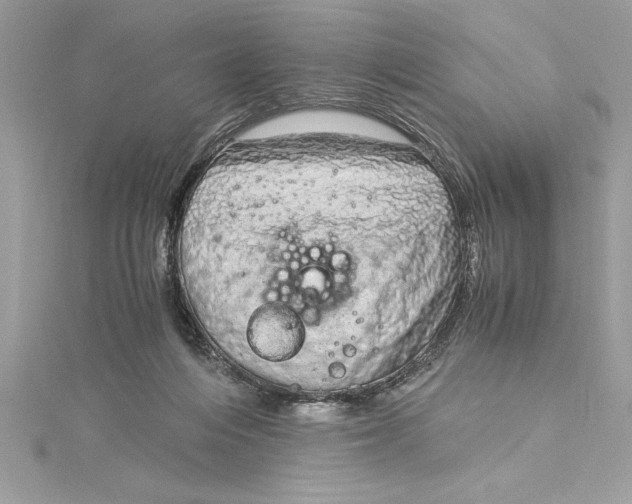 X0000115020216200911161453