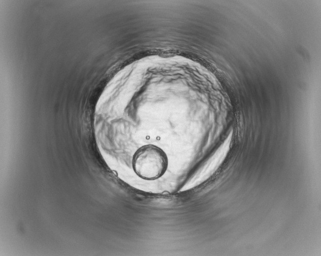 X0000115020236200911161453