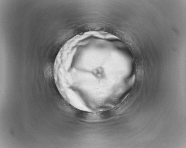 X0000115020335200911161451