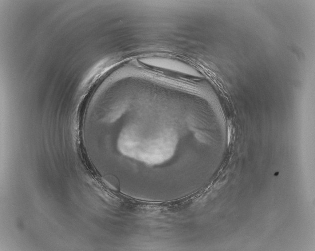 X0000115020339200911161451