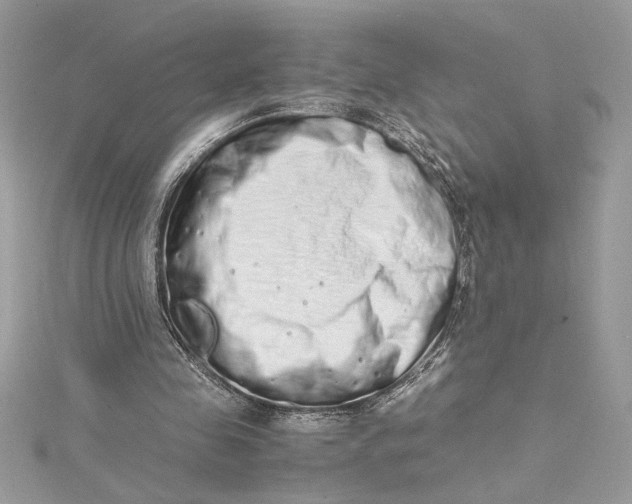 X0000115020341200911161451