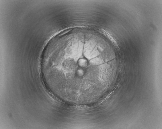 X0000115020346200911161451