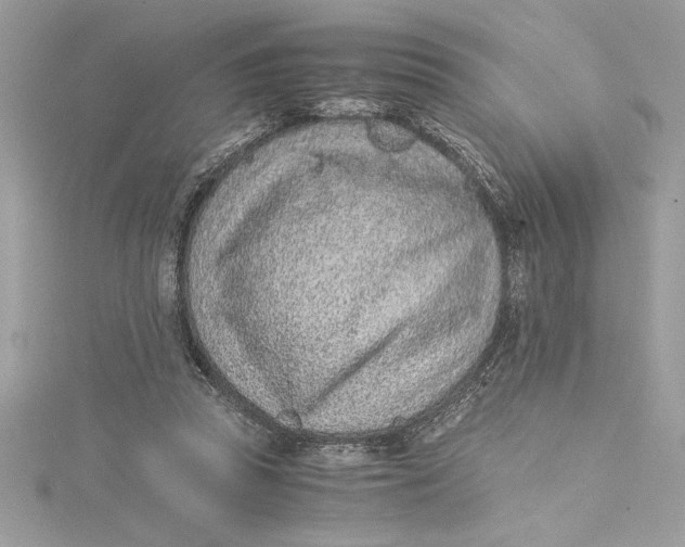 X0000115020353200911161451